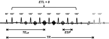 fse parameters questions and answers in mri