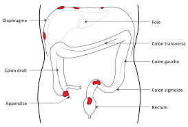 « service avis médical en ligne » vous permettant de. Endometriose Digestive A Lyon Centre Lyonnais De Chirurgie Digestive