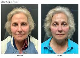 RUWANTHI CAMPANO, MD