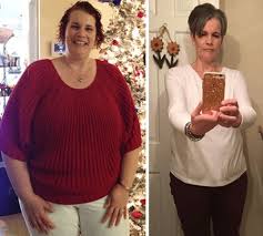 our weight loss surgery patients share