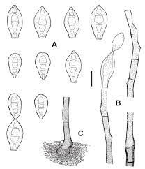2006 (for references in articles please use ncbi:txid2006). Veramycella Bispora From Holotype Bpi 878843 A Conidia B Download Scientific Diagram