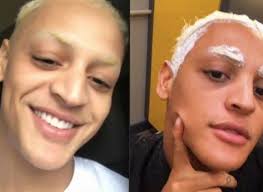 Ela é filha da enfermeira verônica e irmã gêmea de phamella. Noticias No Instagram Pabllo Vittar Mostra Resultado Das Cirurgias No Nariz Veja Antes E Depois Portal Do Zacarias A Verdade Da Informacao Em Primeiro Lugar