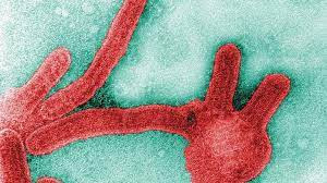 2 days ago · this is the first time marburg, a highly infectious disease that causes haemorrhagic fever, has been identified in the country, and in west africa. Vxlzctqh4xluwm