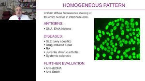 Image result for ANA Staining Pattern