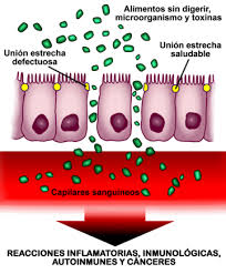 May 26, 2021 · a maía. Esclerosis Multiple Wikipedia La Enciclopedia Libre