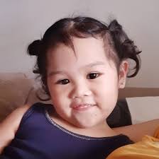 Help raise funds for Mia's surgery