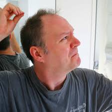 Longer hair may appear to cause more hair loss. Seven Ways To Avoid Hair Loss Men S Hair The Guardian