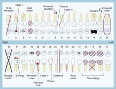 36 Best Dental Charting Images Dental Dental Charting