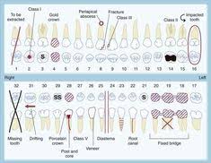 36 Best Dental Charting Images Dental Dental Charting