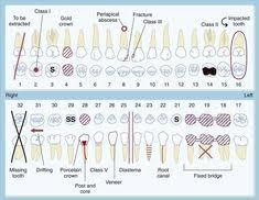 36 best dental charting images dental dental charting