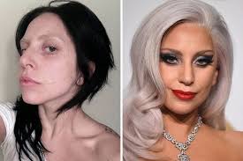 Ungeschminkt, mit zurückgekämmten haaeren und nicht. Lady Gaga Acnebeforeandafter Celebs Without Makeup Celebrity Makeup Transformation Lady Gaga Without Makeup