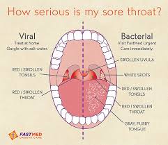 Home Remedies For Preppers Shtf First Aid Survival Life Sick Remedies Health Resources Throat Remedies