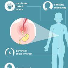Heartburn Signs Symptoms And Complications