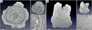 Comparison Of The Uric Acid And Calcium Oxalate Stone Micro Morphology Download Scientific Diagram