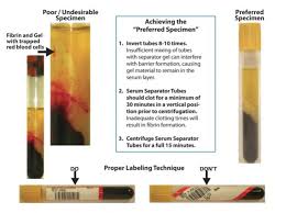 specimen collection laboratory alliance of central new