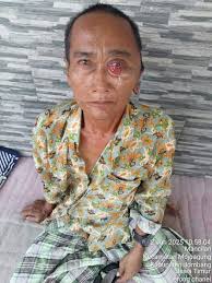 Penyandang Disabilitas di Desa Mancilan kecamatan Mojoagung Jombang Alami  Penganiayaan