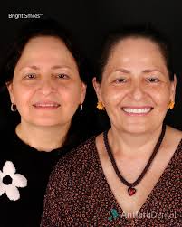 💎 Elisha's new smile can be summed up in just two words ✌️😎 Bright and  beautiful. 3 easy steps of your dental journey 👇🏻 🤳🏻 Send your  #brightsmile 📑 Take advantage of