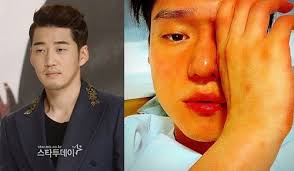 20151220 god콘서트 윤계상 리퀘스트 풀버전, 발걸음. God ë‚ ë²¼ë½ ë©¤ë²„ ìœ¤ê³„ìƒ ë³'ì›ì—ì„œ ë¬´ìŠ¨ì¼ì´ ë§¤ì¼ê²½ì œ