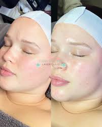 Lara Day Spa and Laser Clinic