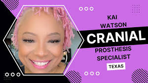 Kai Watson: Cranial Prosthesis Sugar Land, Texas