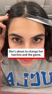 DIY Hairline Fix Breaks the Internet