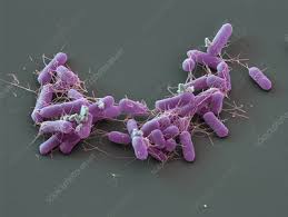 Salmonella infection (salmonellosis) is a common bacterial disease that affects the intestinal tract. Salmonella Enteritidis Keyword Search Science Photo Library