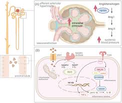 Image result for Hyperuricemia