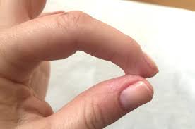 Tikus yang masuk ke dalam rumah bisa memakan persediaan makanan. 7 Cara Hilangkan Gam Gajah Super Glue Pada Tangan Kasut Baju Dan Plastik