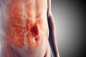 Image result for stomach hernia symptoms