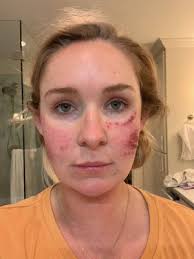 Regenesis, 4601 Whitesburg Dr SE, Ste 103, Huntsville, AL 35802, US