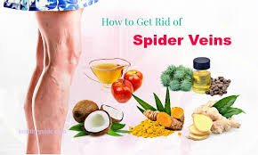 One of the biggest benefits of antioxidants is that they boost the immune system and can help improve the circulation of the blood. 45 Tips How To Get Rid Of Spider Veins On Face Nose Chest Legs Ankles