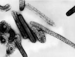 Marburg virus is a hemorrhagic fever virus of the filoviridae family of viruses and a member of the species marburg marburgvirus, genus marburgvirus. Fiebre Hemorragica De Marburgo En Uganda Actualizacion Miradorsalud Ve