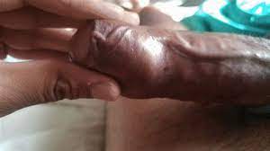 More importantly the doctor talks about the great importance of vitamin d and how it has a big impact on the health of your immune system. Uncut Huge Head Cloudy Girl Pics