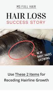 How To Reverse Receding Hairline At Temples Use This Natural Treatment Hair Loss Remedies Hair Loss Natural Care