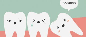 Slikovni rezultat za umnjaci