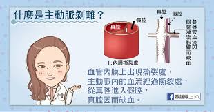 56829 12 3 4 5 6 7 8 9 10. å¼·çƒˆæ'•è£‚æ€§èƒ¸ç—› ä¸»å‹•è„ˆå‰é›¢ æ‡¶äººåŒ… ç…§è­·ç·šä¸Š