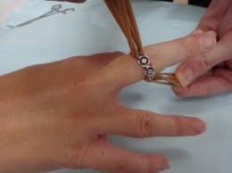 Image result for Ring Removal