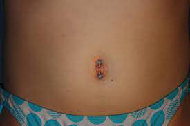 Outie Belly Button Piercing Pain Aftercare Jewelry Pictures Body Piercing Magazine