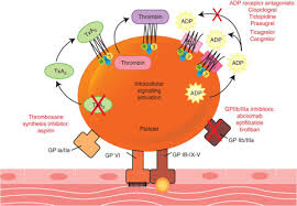 Teurer als mcdonalds oder burger king, dafür aber mit dem versprechen, auch. Perioperative Management Of Antiplatelet Therapy Sciencedirect