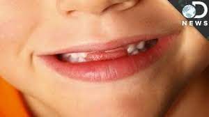 If you mess up s then most always. Why Do Some People Have Lisps Youtube