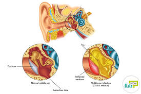 Fit the sock on your child's foot, so that the pouch securely stays in place on the sole of her foot. 5 Home Remedies For Ear Infections No 1 Provides Instant Relief