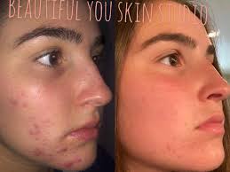 Beautiful You Skin Studio