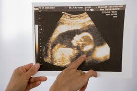 If you do not include a return fax number, it will take about two weeks. When A Baby Turns Head Down During Pregnancy To Prep For Birth