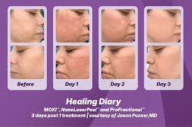 I Tried ScitonStaX™ Live at Skin CEO: Boosted—And Here's What Happened