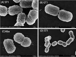 Image result for Striga baumannii