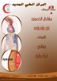 مشاكل الخصيتين alexandria new medical center anmc facebook