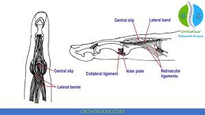 Image result for Elson Extensor Tendon Test