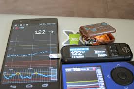Xdrip By Stephenblackwasalreadytaken Diabetes Type 1 Diabetes Insulin