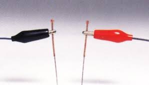 Electro-Acupuncture | TCM Health Care Centre