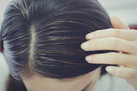 Punca masalah rambut gugur ada juga berkaitan dengan masalah dalaman kita yang kurang baik, contoh biasanya bila kita menghadapi masalah buah pinggang boleh juga menyebabkan rambut kita gugur, ada yang semakin teruk, dan juga masalah penyakit yang lain. Muda Lagi Tapi Rambut Dah Beruban Ini 4 Sebab Uban Tumbuh Terlalu Awal